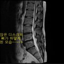 삼성바른신경외과 이미지