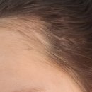 신미헤어라인 이미지