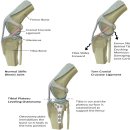 차고치는집 | 대전 강아지 십자인대 파열 TPLO 수술 잘하는 곳 봉명동 숲 동물의료센터 내돈내산 후기