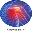 뼈관절에 좋은 음식 7가지 이미지