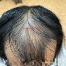 르네시떼 이미지