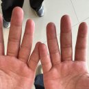 365단골한의원 | 청주 한의원 율량동한의원 치료 잘하는곳!!본인이 다녀본 후기❗️