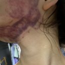 화생약국 | 계산동피부관리 탐날에스테틱 인천계양본점 계양구 작전역 윤곽관리 퀵프팅 후기