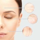 은계디스퀘어큐브 | 은계지구피부과, 콜라겐부스터 <쥬베룩>