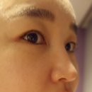 피부맑음 이미지