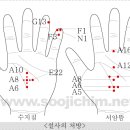 뜸 이미지
