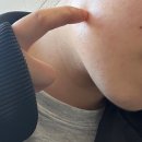 광교프라자약국 | 구강악안면외과 추천! 매복 사랑니 발치, 10일차까지 일반인 고객의 광교 프라자치과 솔직후기 광고아님!