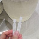 메트로치과의원 | 대구 메트로안과 스마일라식 한달차 후기