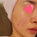 이영란스킨케어 이미지