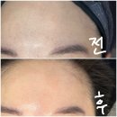 YJskincare | 울산 남구 피부관리실 유진스킨케어 건조+모공관리,엑소가 부스터+물방울리프팅 후기!
