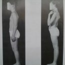 Triceps surae Muscle Length Test : 가지미근과 비복근 추가 설명 이미지