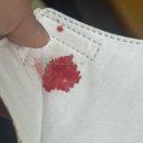 뉴드림약국 | 6살 어린이 A형독감 후기 격리기간 수액 금액 보험청구 (+ 성인 A형독감)