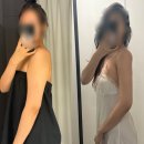 멍스타일 | 3달차 팔 람스 후기 | 람스 붓기 멍 빠지는 시기•인천팔뚝주사