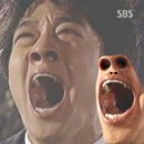치루수술 후기 7) - 치루 완치 판정(끝)