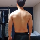 김승현한의원 | 헬스 스쿼트 잘못된 자세 허리디스크 부상