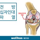 전방십자인대파열이란 무엇인가? 이미지