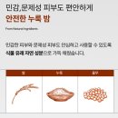 조선약국 | 트라넥삼산 들어간 진짜 약국 기미크림 찾는다면? 위자드조선 누룩밤 추천!