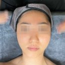 지에스이십오 오투그란데점 | 군산 피부윤곽관리 ‘보금뷰티’ 피코토닝, 크레이지리프팅 후기