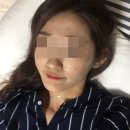늘고운한의원 | 여드름색소침착 자국 케어 만족 후기