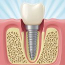 센트럴뉴욕치과의원 이미지