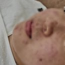 매곡고등학교 | 울산북구매곡동피부관리 고등학생 예민한 피부를 관리 받고 온 더맑은스킨 울산매곡점