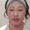 더블유안과의원 이미지