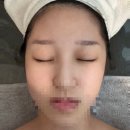 라벨르피부관리실 | [대구/경산] 경산 피부관리 ‘라벨르 피부관리실’ 물광 수분 충전 후기