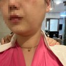 학정로 439 | 북구 동천동에스테틱 '정명순 내면미용' 에서 받은 얼굴축소관리 솔직 후기