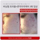 오닉스스킨테라피 네이버블로그