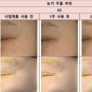 바이홉 네이버블로그