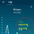 2년전 시술, 올9월부터 평균맥박 상승, 불면증-부정맥아닌 갑상선항진. 황당!!! (그레이브스병) 이미지