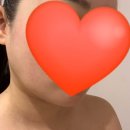 문학초등학교 정문 | 전주 다원에스테닉, 브리업리프팅 받고 온 솔직후기