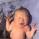 도구제일약국 | [출산후기] 목동제일여성병원 제왕절개 당일_후기, 타임라인, 통증, 운동