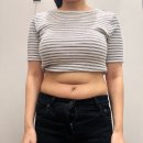 송도제일약국 | 복부 무한람스 당일 후기 송도다이어트병원 아랫배, 윗배, 옆구리 1주차 (통증, 멍, 붓기, 부작용)