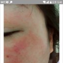 김세연 에스테틱 | 김영주고객님 관리후기