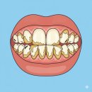 큐프라임인하치과의원 | 큐프라임 인하 치과 스케일링, 치석제거에 대하여…