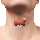 갑상선 결절[thyroid nodule]이란? 이미지