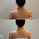 더홀릭대구수성점 | 더에스테틱수미원 대구수성점 작은얼굴관리 내돈내산 후기