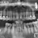 유플란트치과의원 이미지