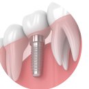 좋은솜씨죽전치과의원 이미지