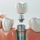 강서김치과의원 이미지