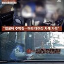 중앙일보 JTBC 노동조합 | 서울 강남 택시기사 폭행(폭력) 사건! 뇌출혈! 이유? 택시비 요금 2만원 요구, 술 취한 승객, 머리 걷어차?