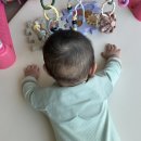 경북대학교병원 | 👶🏻 두상 교정 후기 ep 01. 경북대학교병원 성형외과 • 대호보조기상사