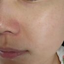 올메디 | 민감피부 PDRN앰플 진정 보습 케어, 에스테인 올스킨 메디포뮬러 앰플 사용 후기