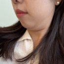 대구 동성로 피부과 온다리프팅 후기 통증 전후/ 내돈내산