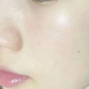 햇빛주는 약국 | 멜라토닝크림 약국 기미크림 부작용 줄여주기 필요한 이것?