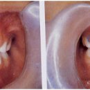 우리 아기의 치아가 제대로 나고 있는 건지? 이미지