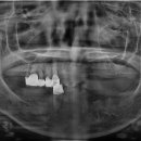 열린오치과의원 이미지
