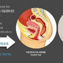 큐어람한의원 이미지