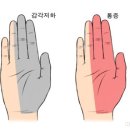 뜸